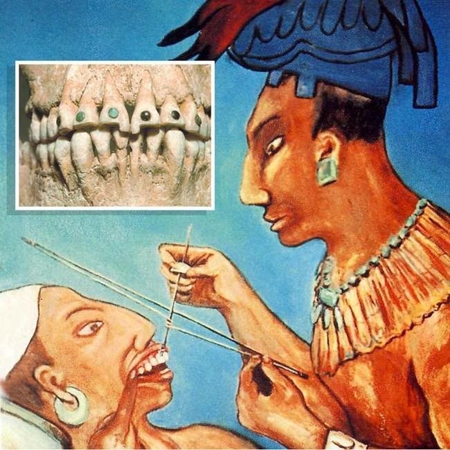 Curiosidades sobre los dientes clinica dental sanlázaro