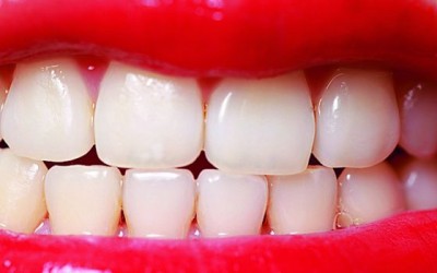 Por qué amarillean los dientes a pesar de cepillarlos a diario?