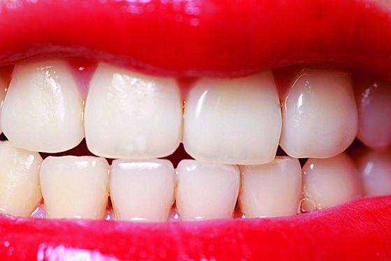 Por qué amarillean los dientes a pesar de cepillarlos a diario?